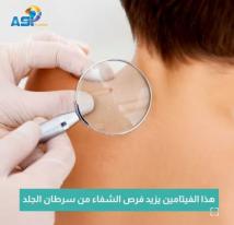 فيديو: هذا الفيتانين يزيد فرص الشفاء من سرطان الجلد(1د 24ث)