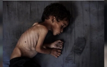 أوبئة الشلل تفتك بأطفال غزة المحاصرة