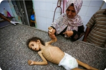 الأطفال يتساقطون جوعًا في شوارع غزة