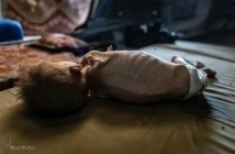 تجويع مصمم هندسيًا وسياسيًا.. إسرائيل تصنع الجوع في غزة 