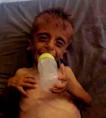 في غزة .. العدس بدل الحليب صراع يومي من أجل البقاء