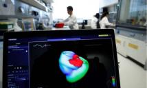 دراسة: الذكاء الاصطناعي يتيح لرسم القلب العادي كشف عيوب بنيوية